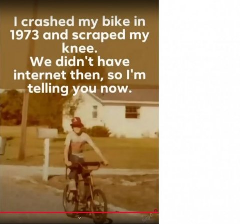 SM-8-bruised knee in 73-no internet.jpg