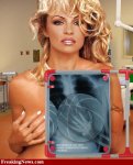 Xray-of-Pamela-Anderson--25127.jpg