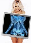 FUNNY-Pamela-XRay-445.jpg